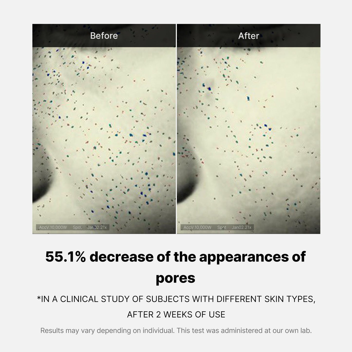 pore-care-duo-l4 05_12ddab8a-64be-4612-8ee1-27e5ec701921.jpg