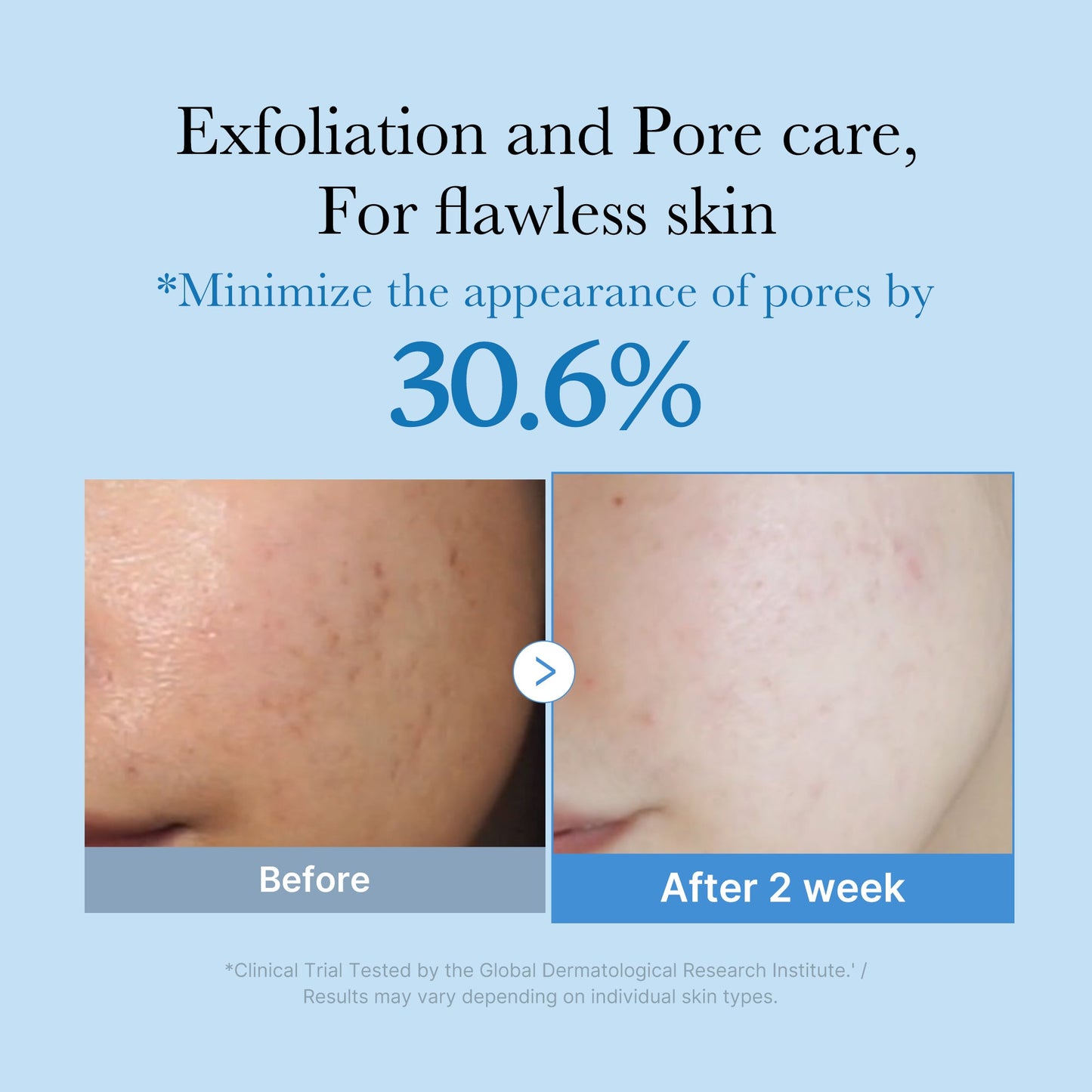 zero-pore-toner-f7 01_d6480b4e-3c08-4954-994a-ed5212c1839c.jpg