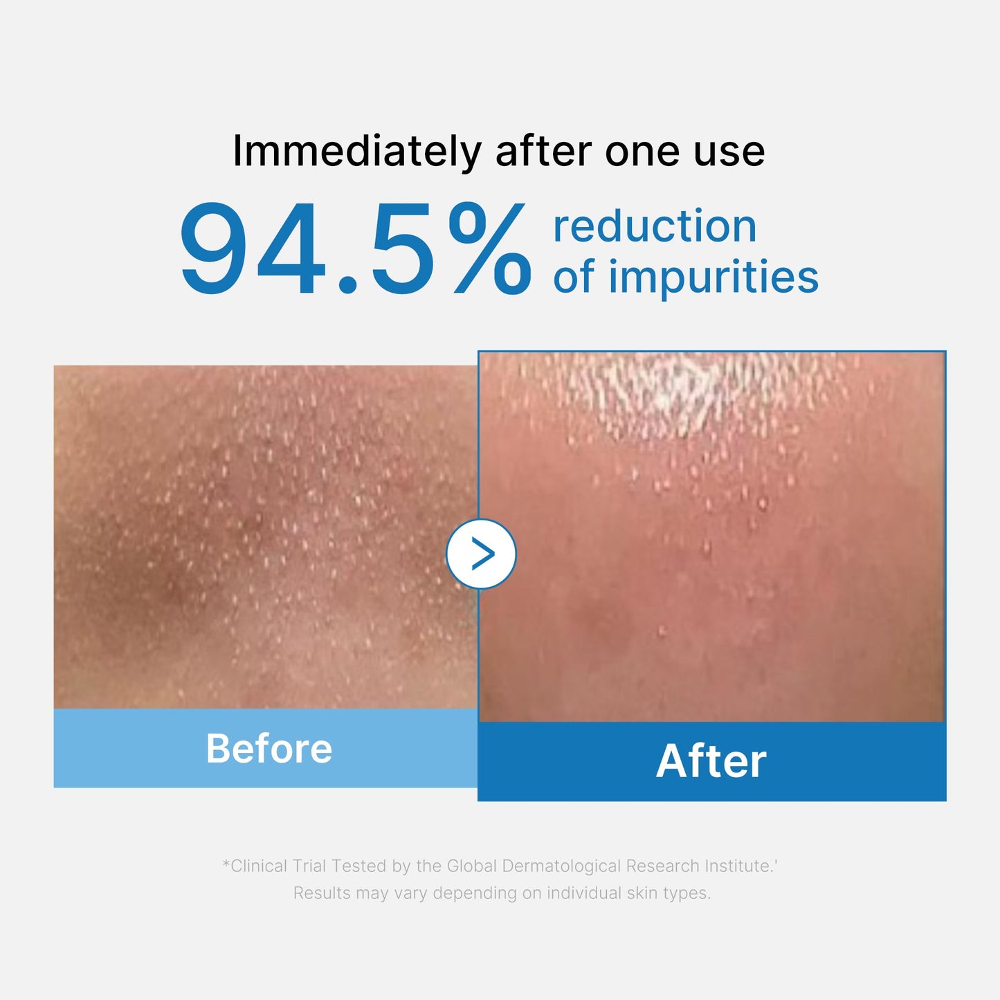 zero-pore-blackhead-deep-cleansing-oil-w1 01_eed557ec-5857-46a2-8b17-dbd67c692dcb.jpg