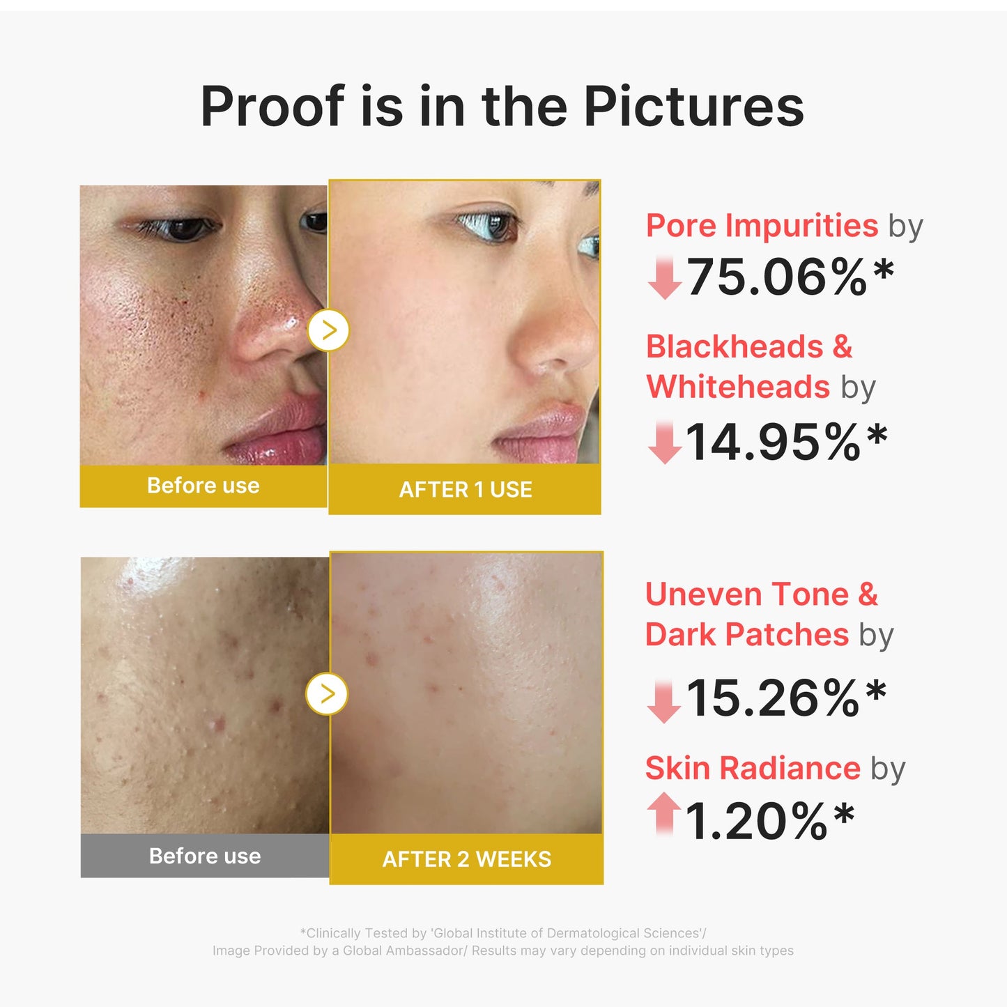 kojic-acid-turmeric-peel-shot-f3 02_45fe66d3-b3f6-4100-aa52-2afd7eded417.jpg