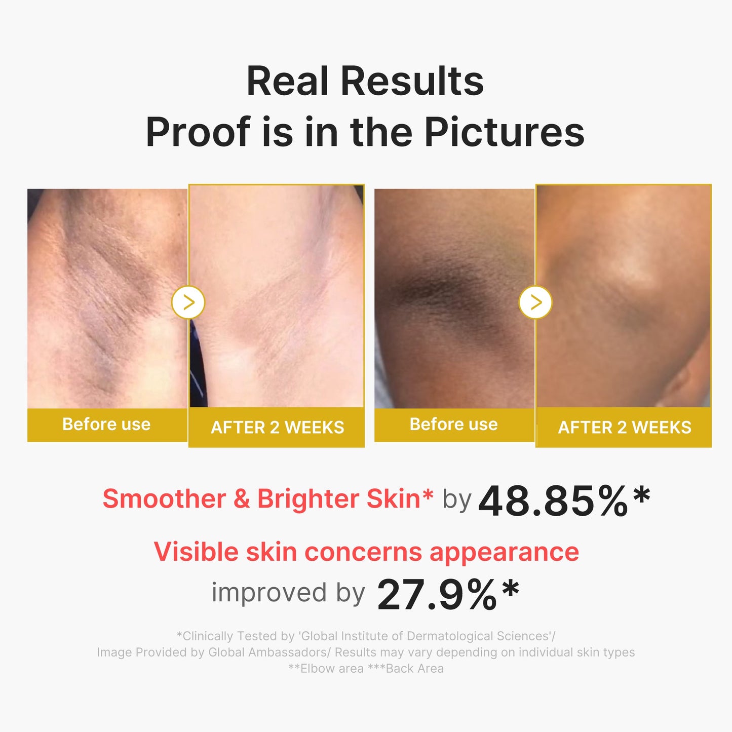 kojic-acid-turmeric-body-peel-shot-x5 02_72880cfc-382b-440b-8152-7e3dce87da2a.jpg