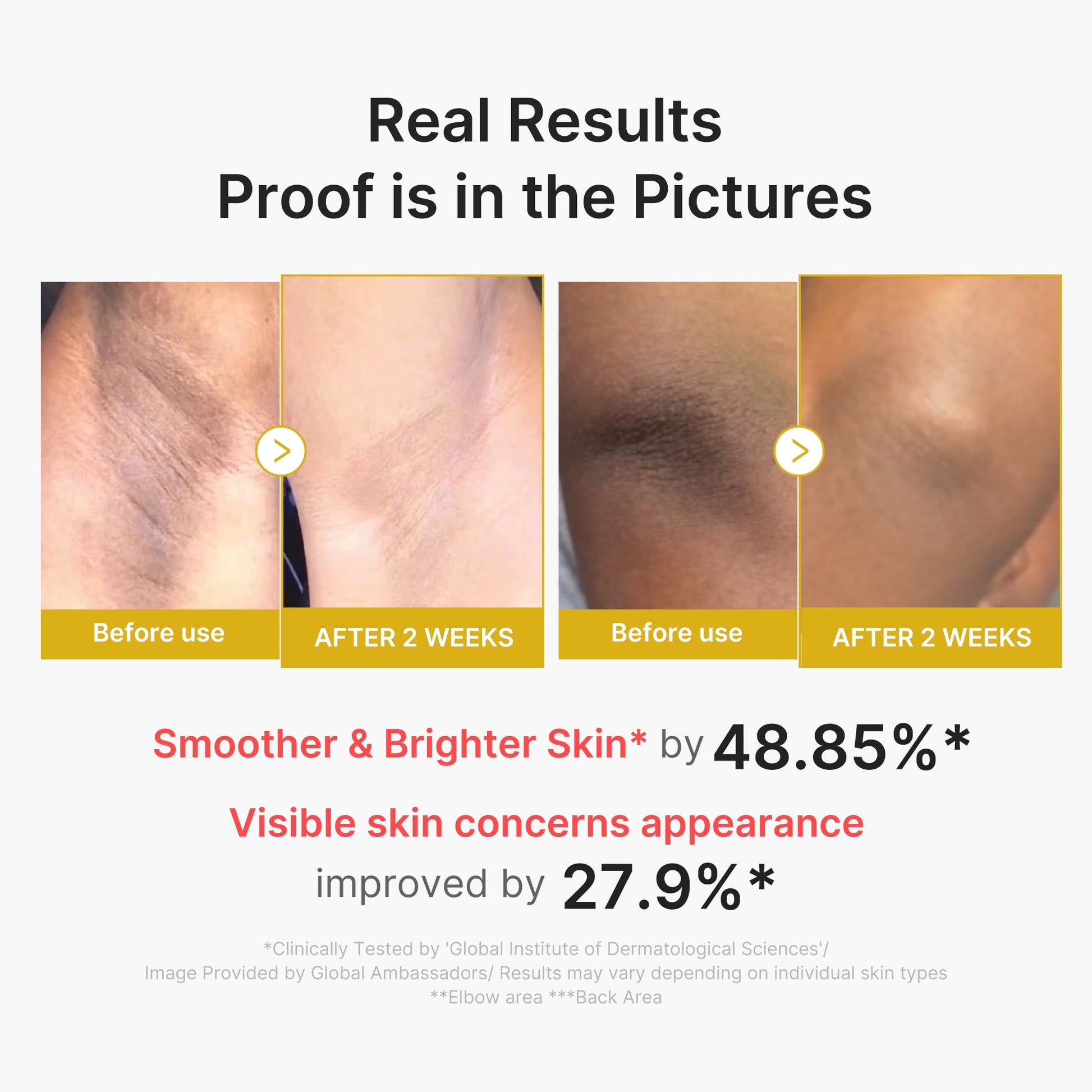 kojic-acid-turmeric-body-peel-shot-x5 02_72880cfc-382b-440b-8152-7e3dce87da2a.jpg