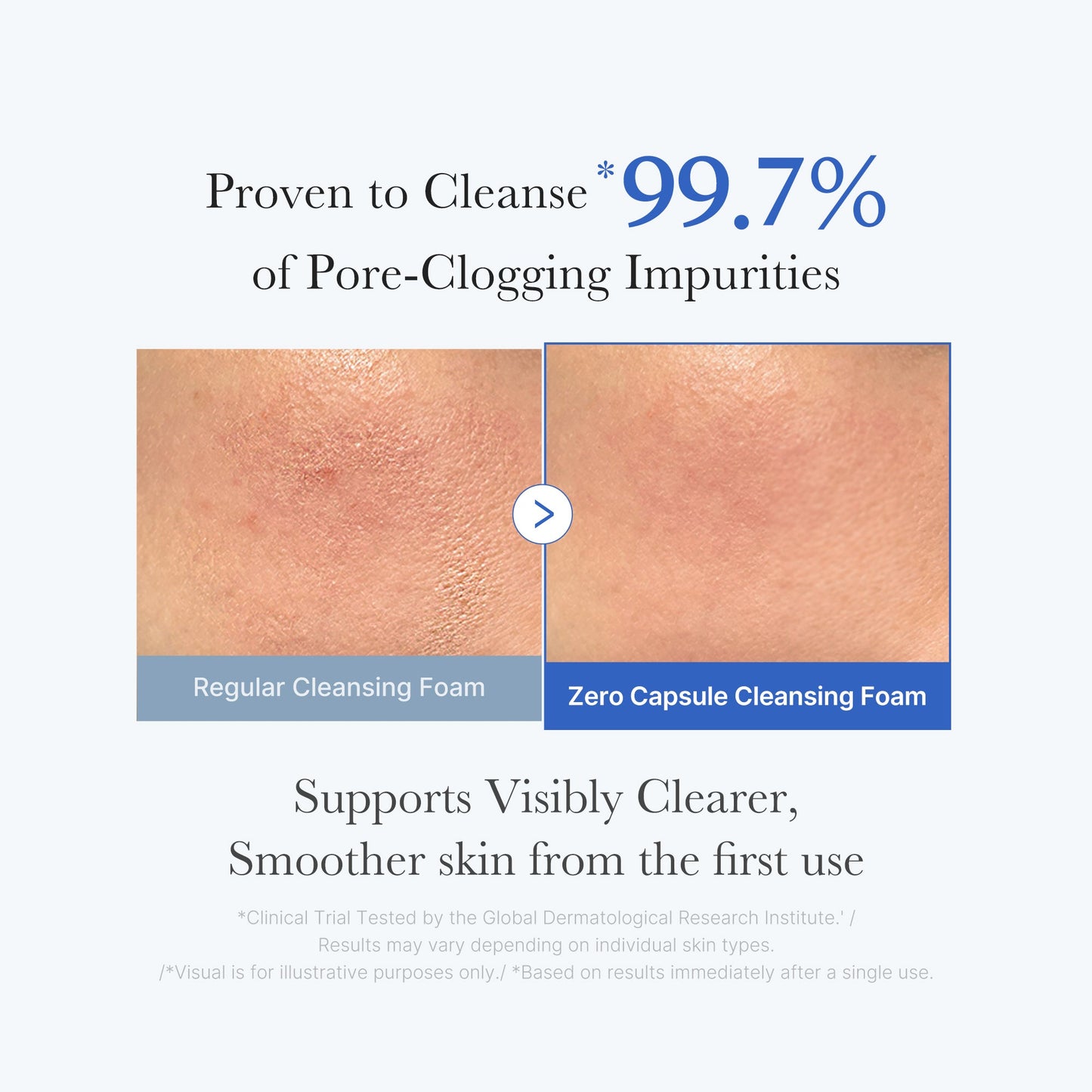 zero-pore-capsule-cleansing-foam-x7 02_c1fb9dfb-86c5-4038-8ff8-490d1006276c.jpg
