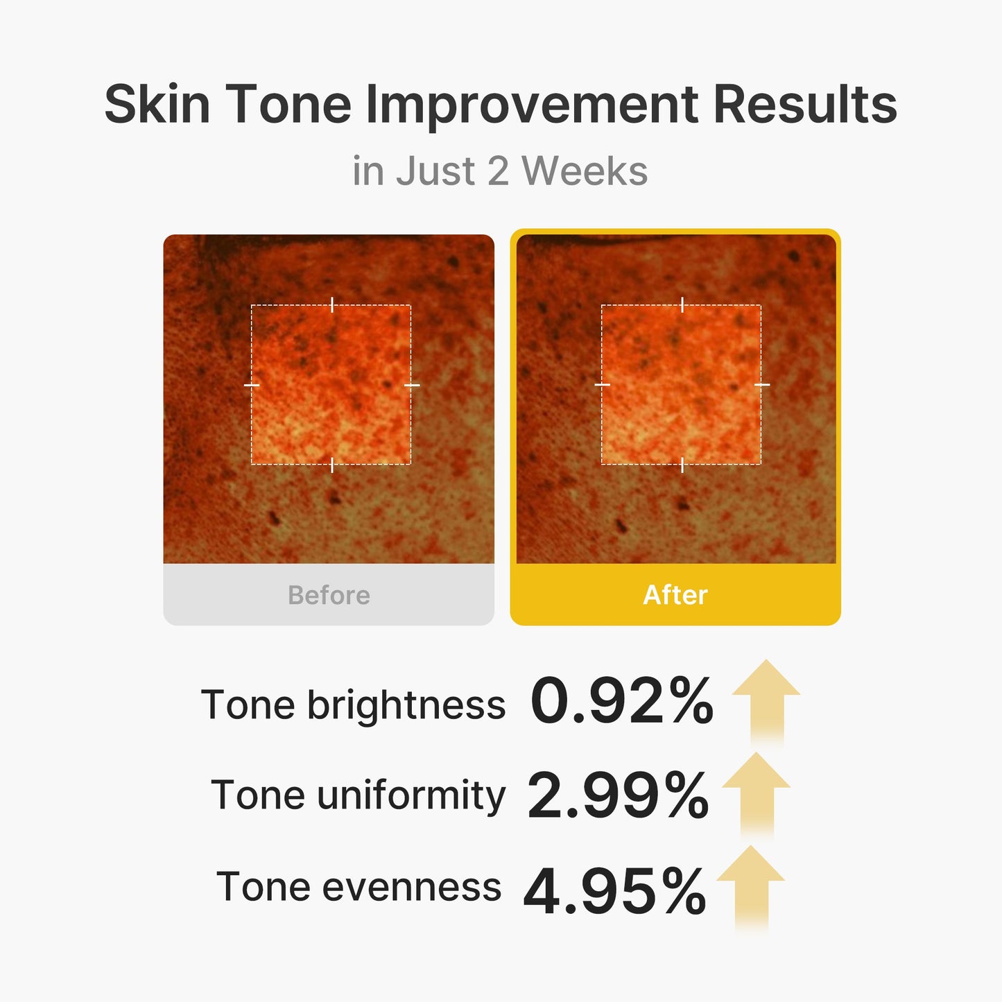 kojic-acid-turmeric-vita-capsule-cream-h2 03_2b626701-fc6c-4702-9e96-a2157a4f7f9d.jpg