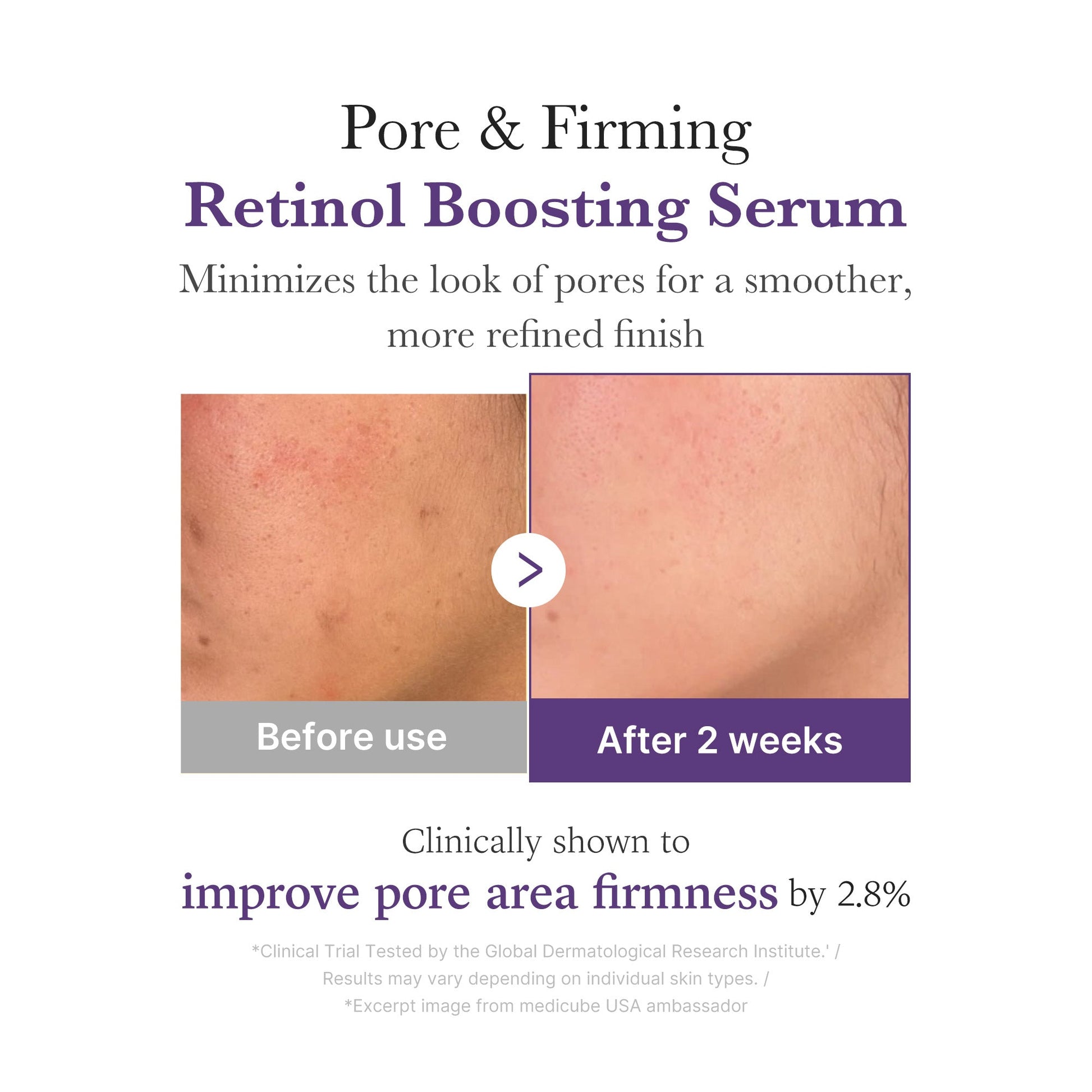 retinol-nmn-boosting-serum-z4 03_3510e7a5-5633-4a18-81ea-1389593bd517.jpg