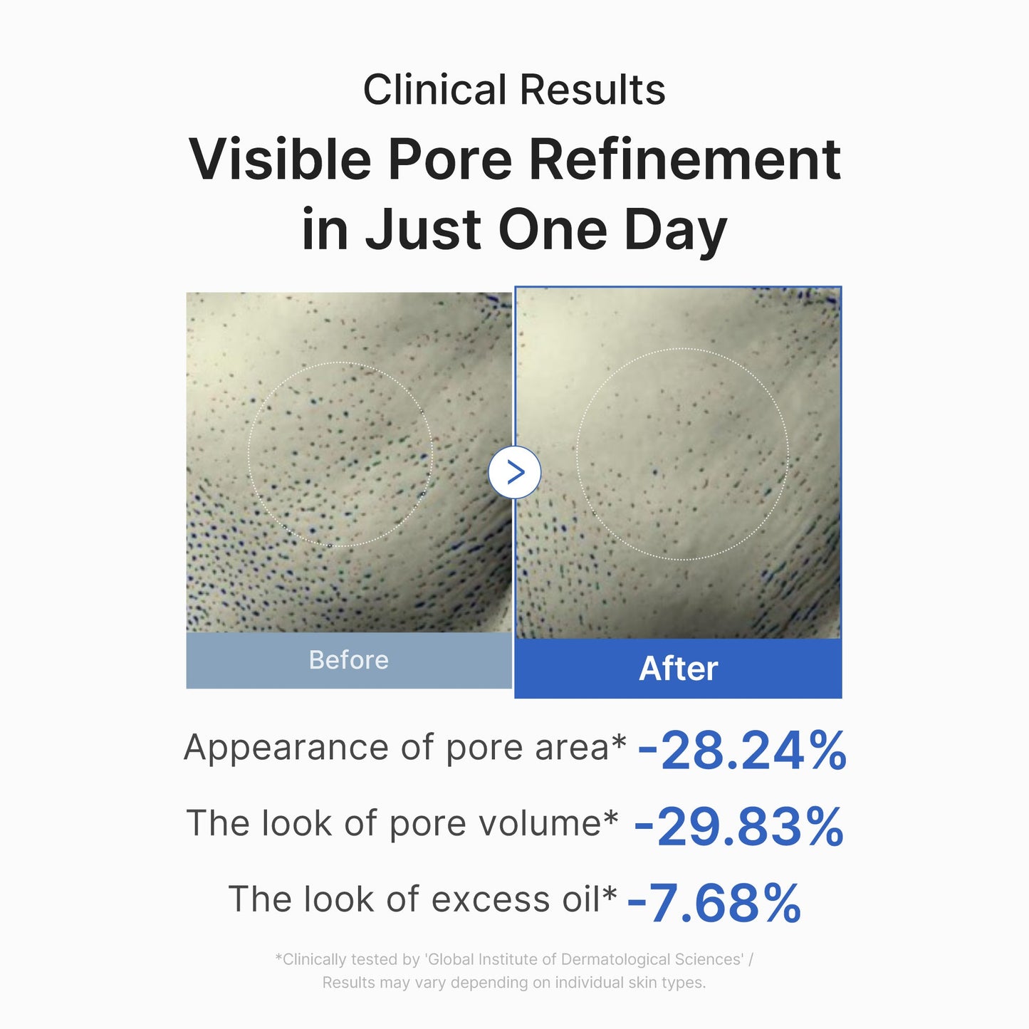 zero-pore-one-day-peptide-serum-e7 03_448eab9e-dc60-4dcb-9e4e-e863aabb61b0.jpg