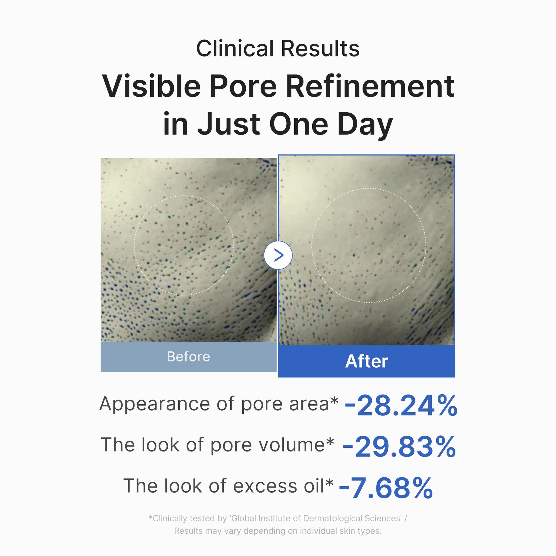 zero-pore-one-day-peptide-serum-e7 03_448eab9e-dc60-4dcb-9e4e-e863aabb61b0.jpg