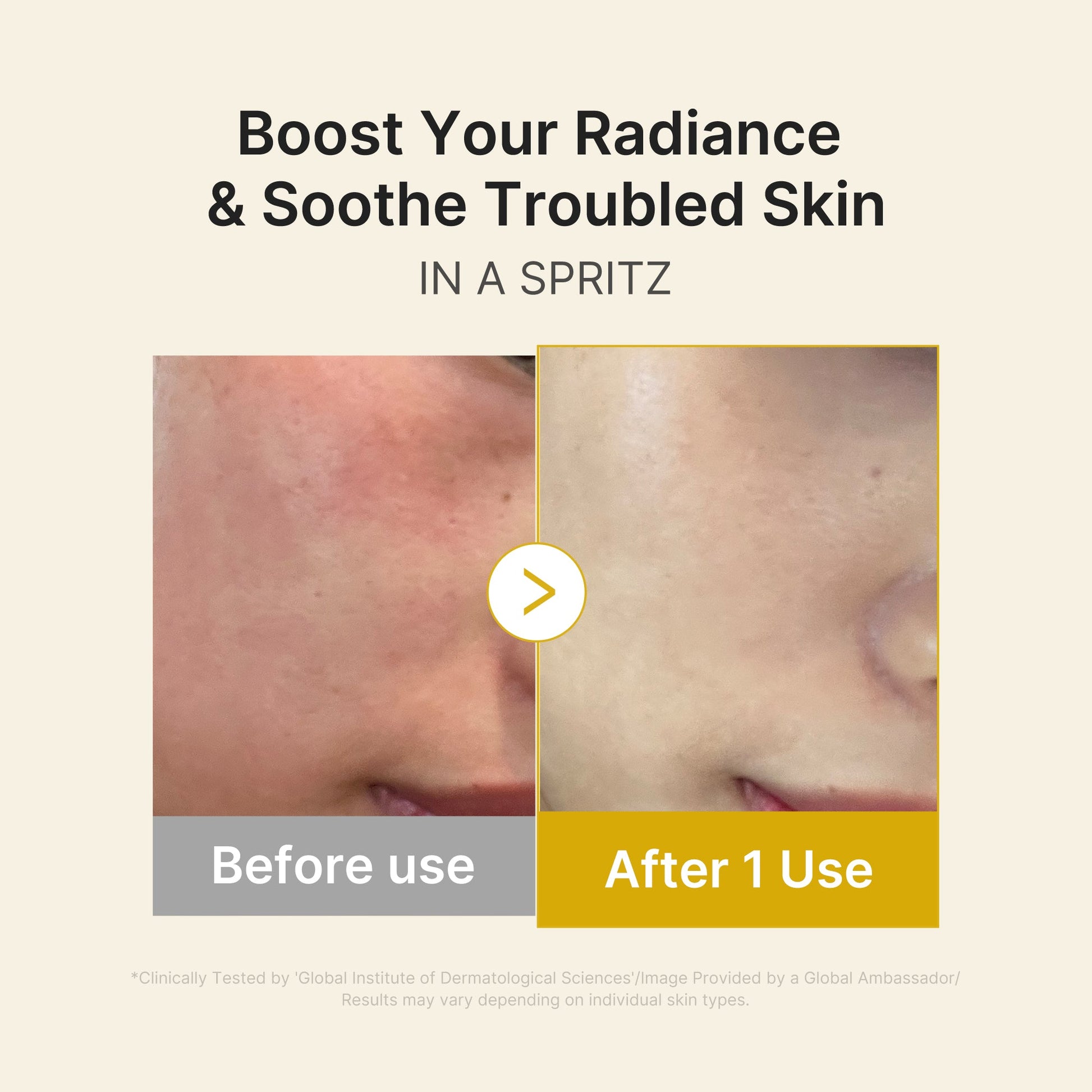 kojic-acid-turmeric-vitamin-gold-jelly-mist-serum-b7 03_dc9cd19e-4e57-49d3-9b66-c7762e8a63f1.jpg