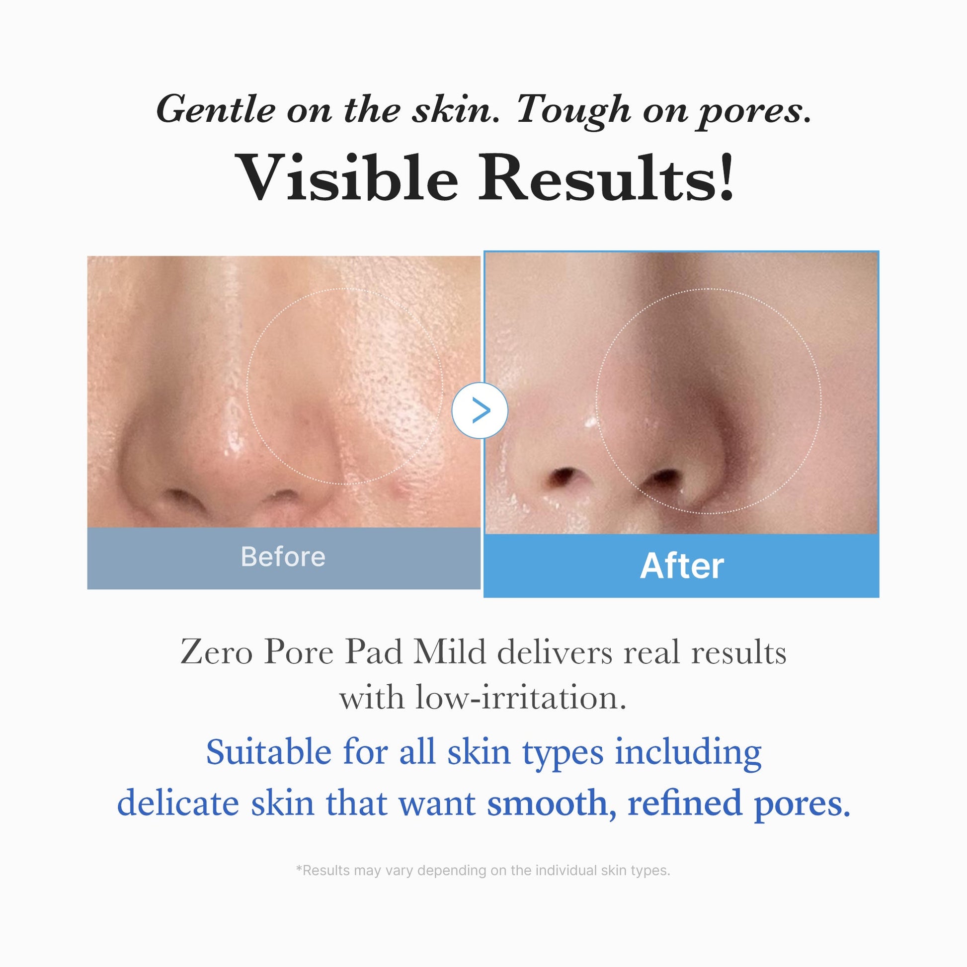 zero-pore-madecassoside-pads-mild-g8 04_6357f9f9-483b-4891-82c6-a58d336e62c8.jpg