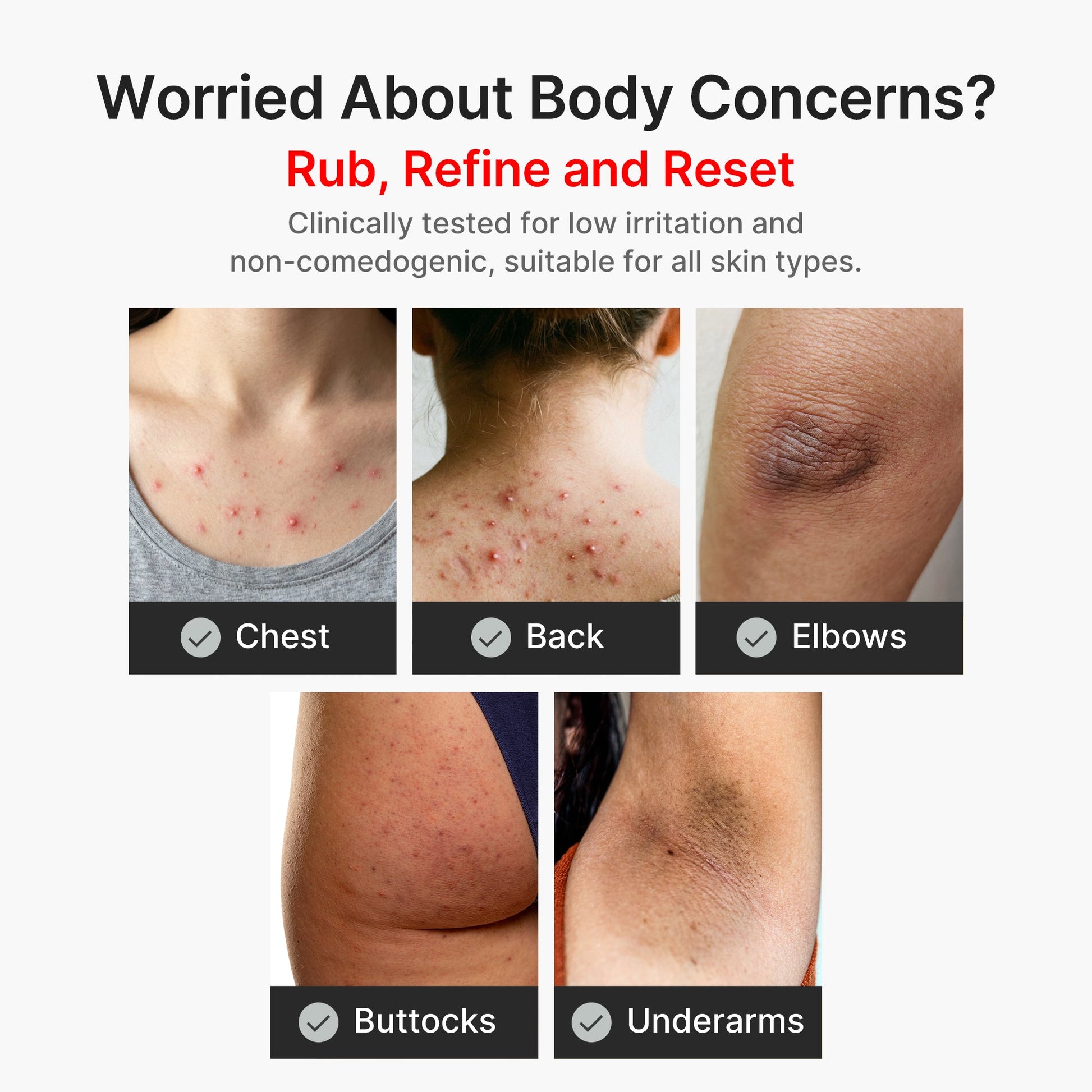 kojic-acid-turmeric-body-peel-shot-x5 04_8a7237f2-3ebf-401e-bd85-54841aeb3efc.jpg