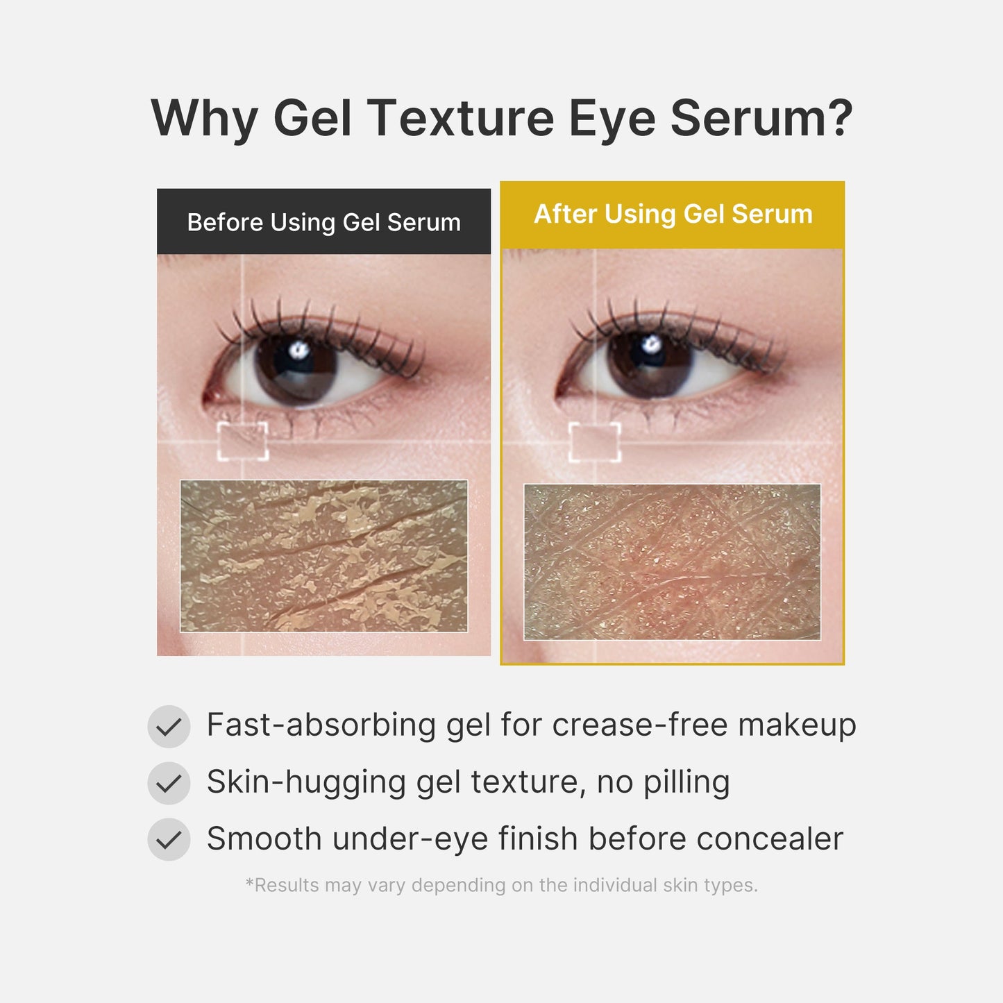 kojic-acid-tumeric-eye-gel-serum-x2 04_0487ef36-49f4-4294-8049-bb55118b05fe.jpg