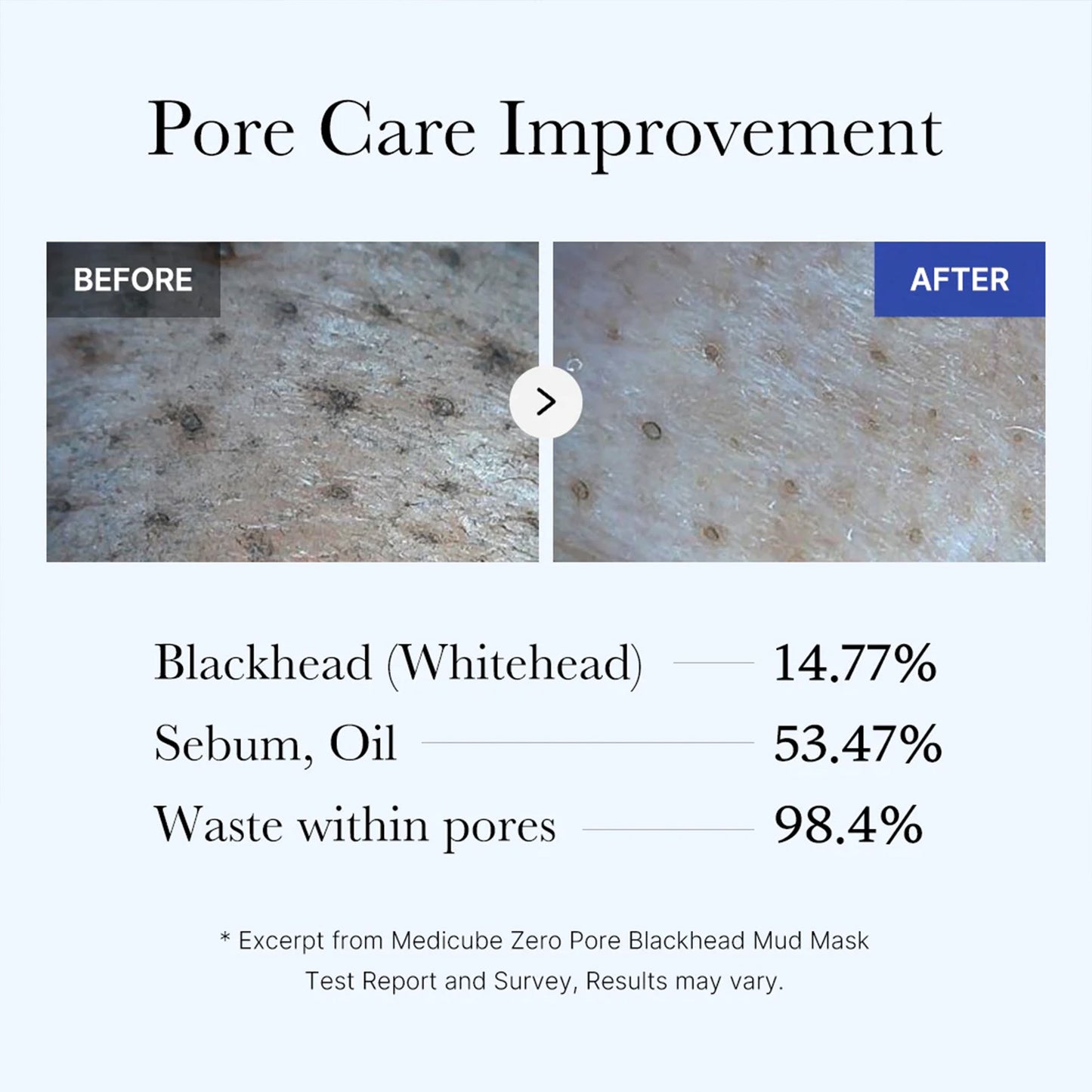 zero-pore-blackhead-mud-mask-p1 05_9362a158-c2b3-4525-acc0-631a2cfdea47.jpg
