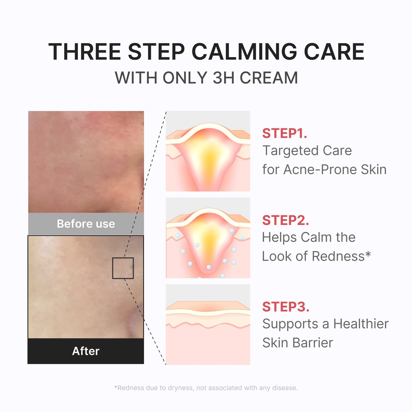 3h-daily-relief-cream-l0 3H_04.jpg