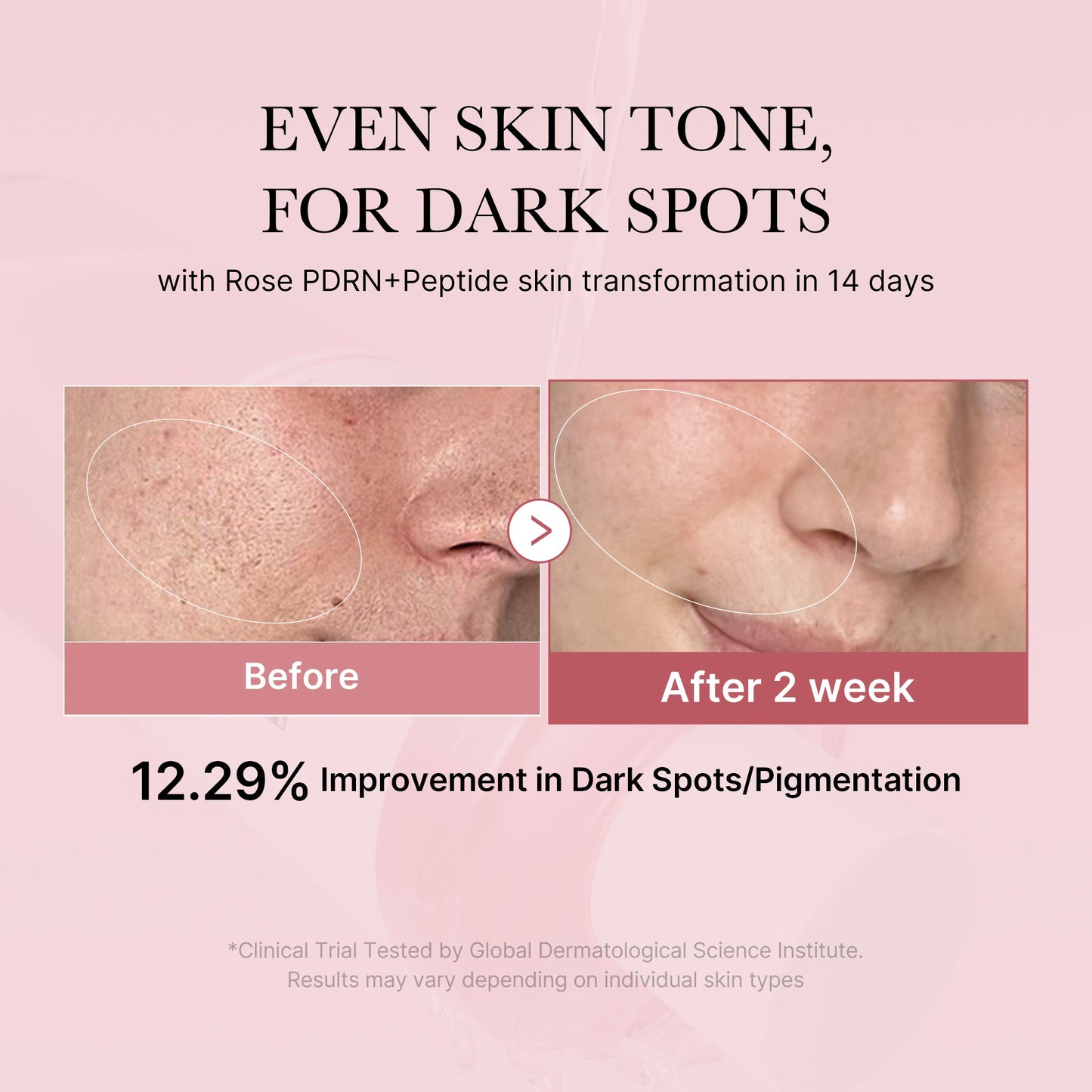 pdrn-pink-peptide-toner-w7 PDRN_01_308c518e-5ac6-4e54-99bd-eabc8796739b.jpg