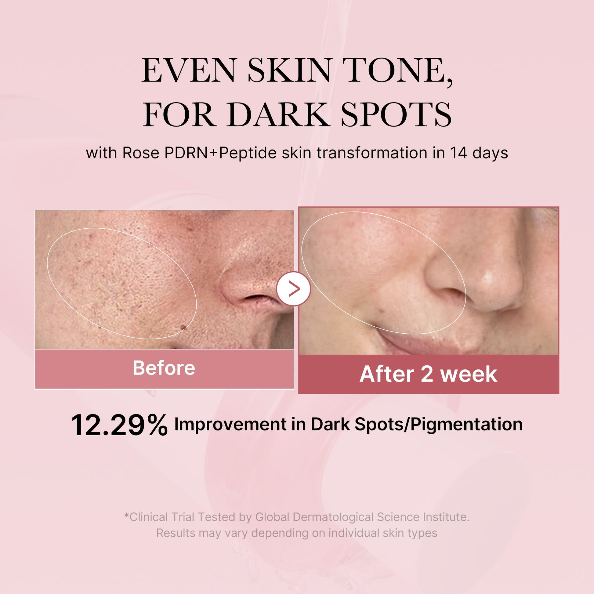 pdrn-pink-peptide-toner-w7 PDRN_01_308c518e-5ac6-4e54-99bd-eabc8796739b.jpg