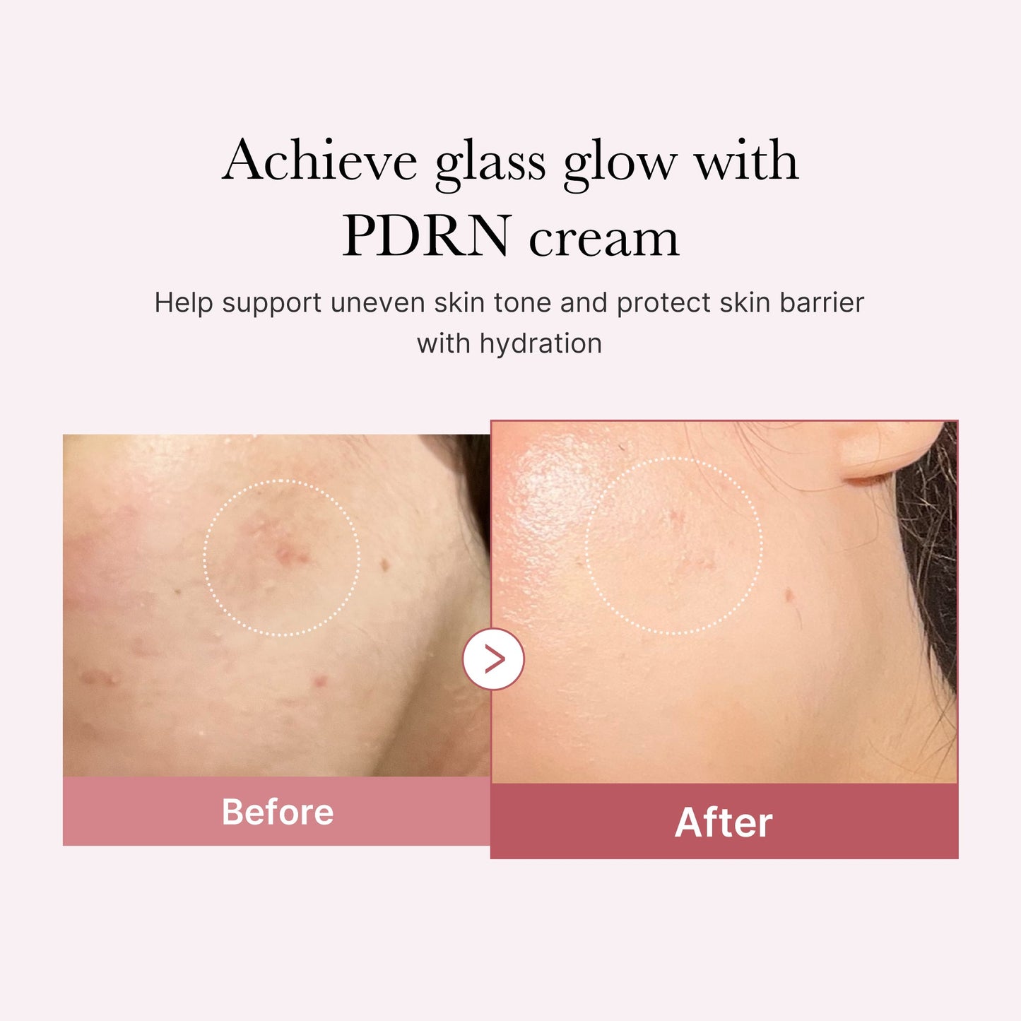pdrn-pink-peptide-cream-j2 PDRN_02_d7805bfe-cf43-446a-b71b-a276683f136b.jpg