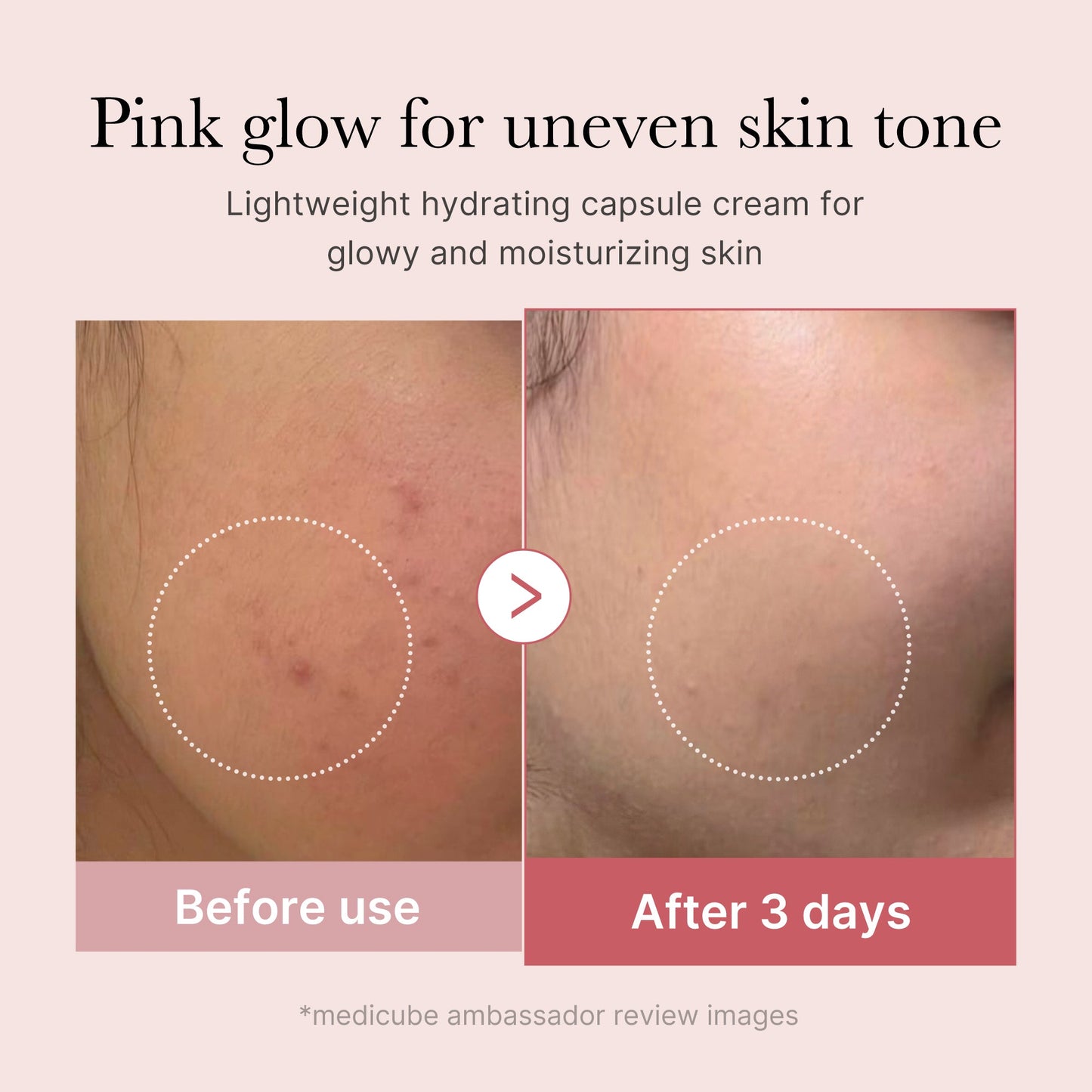pdrn-pink-collagen-capsule-cream-c2 PDRN_03_058d09d8-4f44-4b1e-927c-e27b1738ae51.jpg