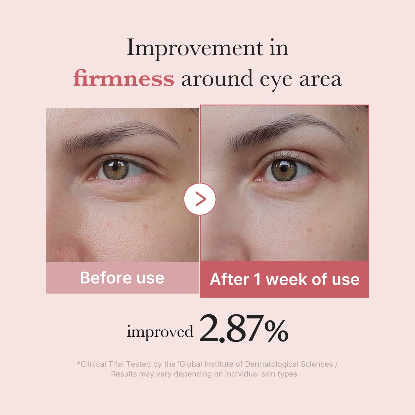 pdrn-pink-peptide-eye-cream-n6 PDRN_03_256dd753-0a2f-41b4-b3cd-bbfd3bc27018.jpg
