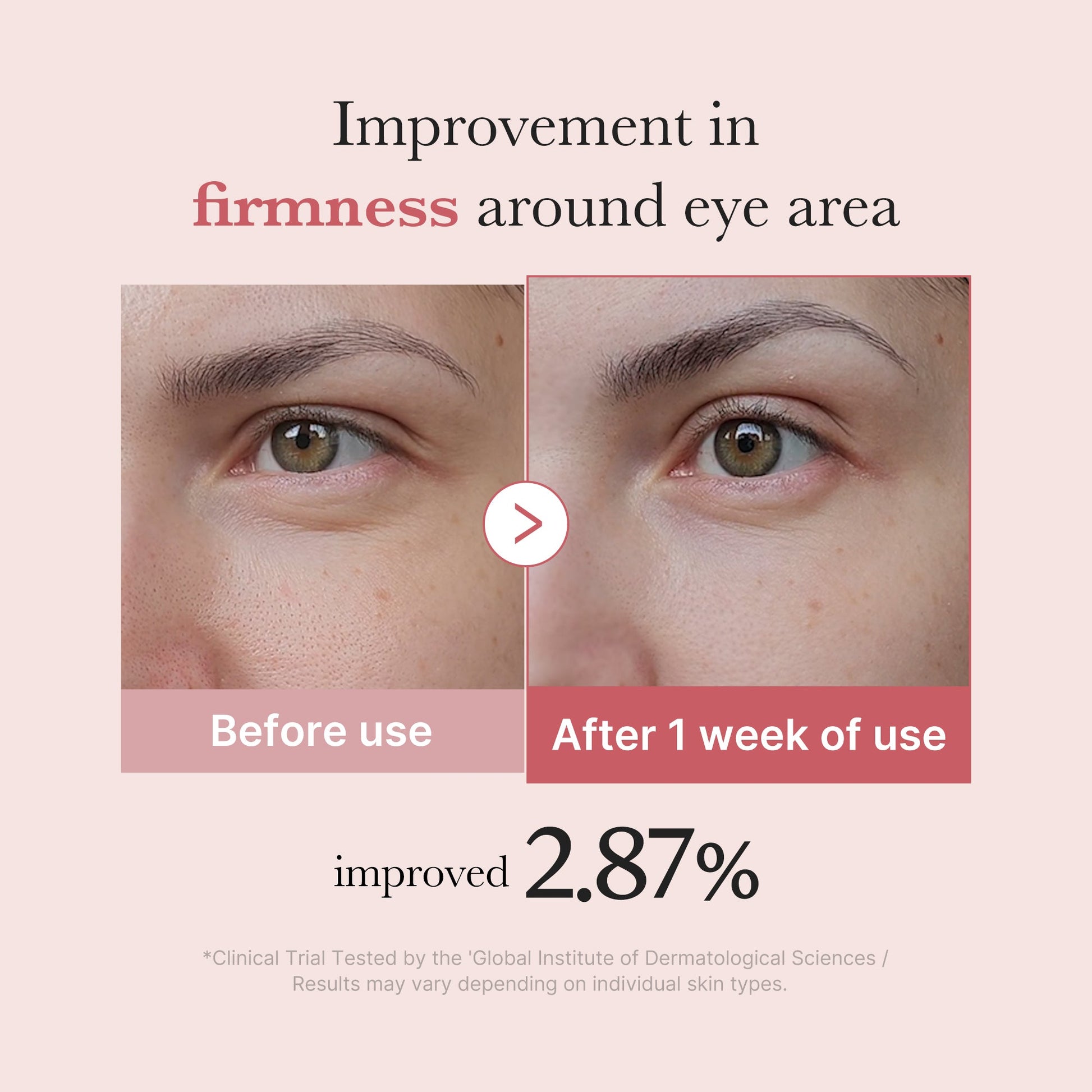 pdrn-pink-peptide-eye-cream-n6 PDRN_03_256dd753-0a2f-41b4-b3cd-bbfd3bc27018.jpg