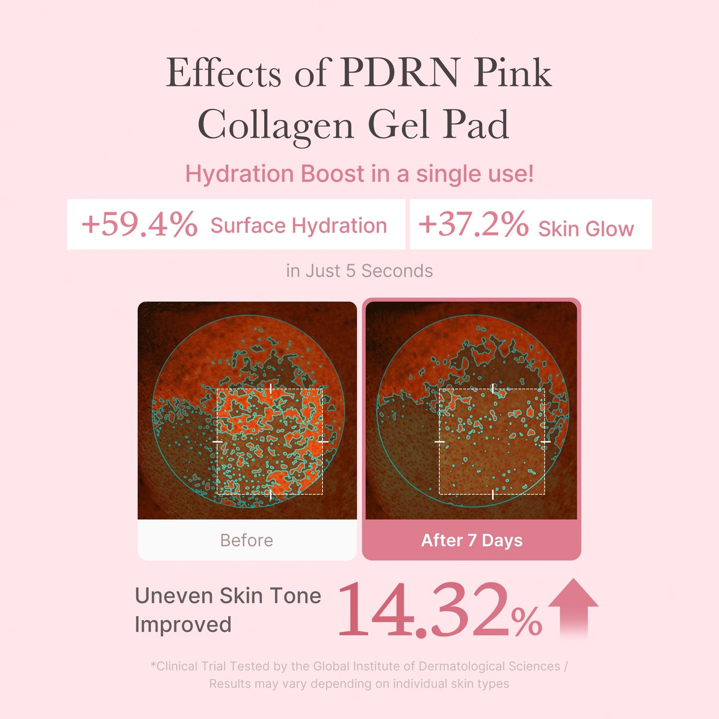 pdrn-pink-collagen-gel-toner-pad-m7 PDRN_04_f9a16a56-8d9e-4c47-a635-ed34ec3ed571.jpg