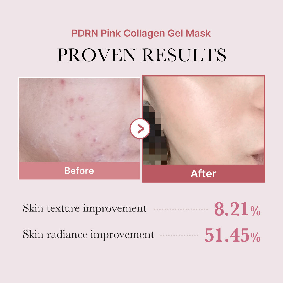 pdrn-pink-glow-full-set-h7 PDRN_12.jpg